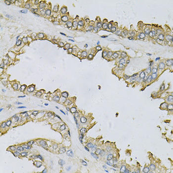 Anti-APRT Antibody (CAB13946)