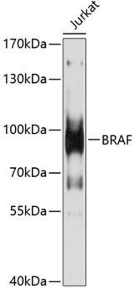 Anti-BRAF Antibody (CAB13953)