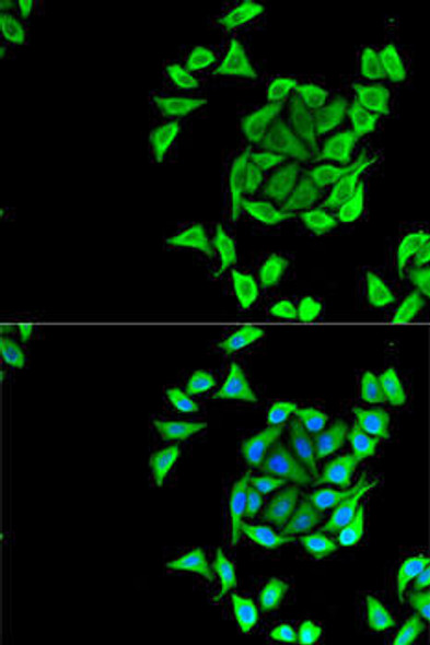 Anti-KCNN3 Antibody (CAB14012)