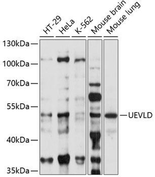 Anti-UEVLD Antibody (CAB14905)