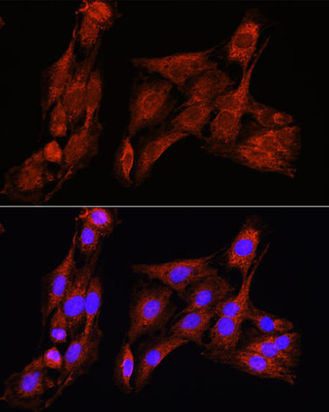 Anti-PSAT1 Antibody (CAB6707)