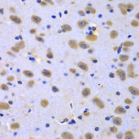 Anti-CIAO1 Antibody (CAB7355)