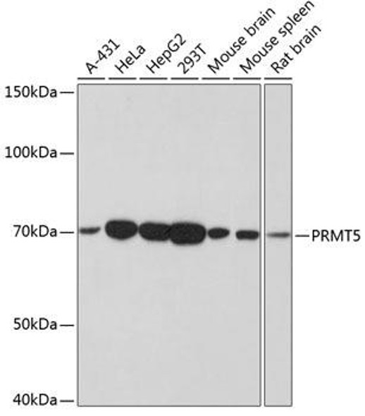 Anti-PRMT5 Antibody (CAB19533)