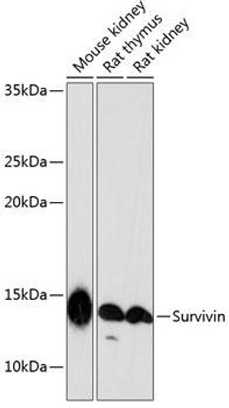 Anti-Survivin Antibody (CAB19663)