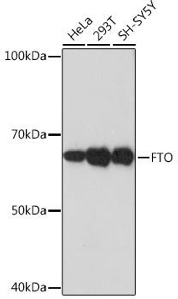 Anti-FTO Antibody (CAB3861)