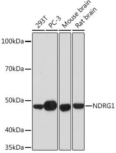 Anti-NDRG1 Antibody (CAB4050)
