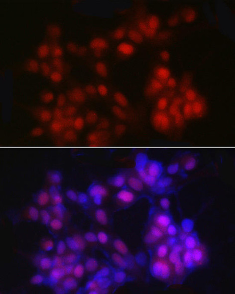 Anti-NKX3.1 Antibody (CAB20539)