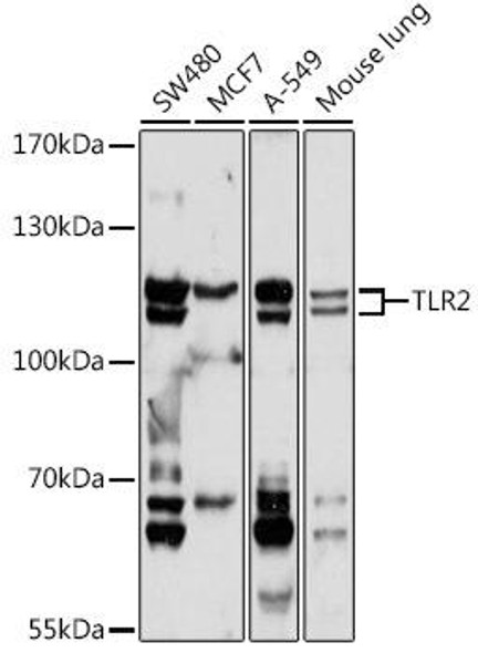 Anti-TLR2 Antibody (CAB20608)