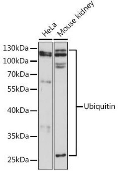 Anti-Ubiquitin Antibody (CAB0162)
