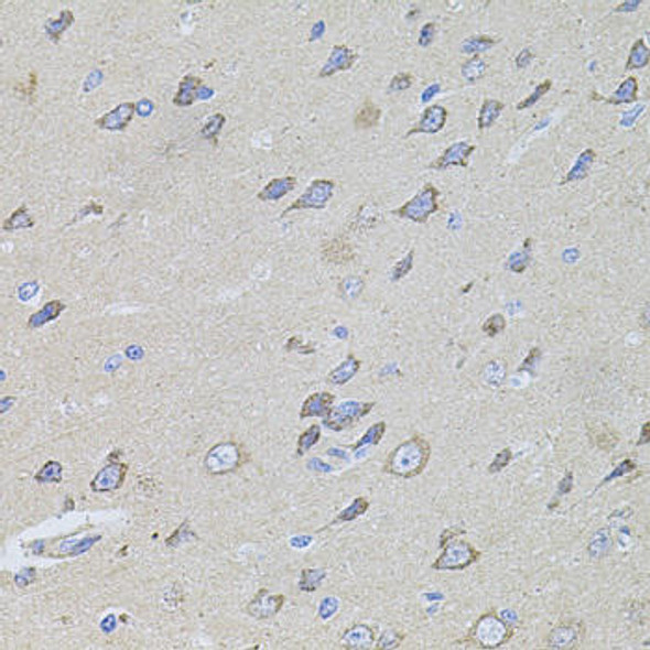 Anti-WISP2 Antibody (CAB12541)