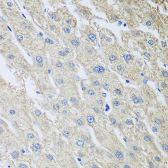 Anti-MLKL Antibody (CAB13450)