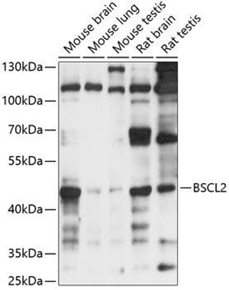 Anti-BSCL2 Antibody (CAB14583)