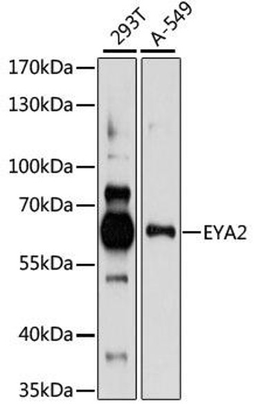 Anti-EYA2 Antibody (CAB15055)