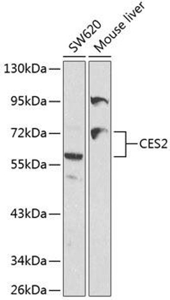 Anti-CES2 Antibody (CAB1514)