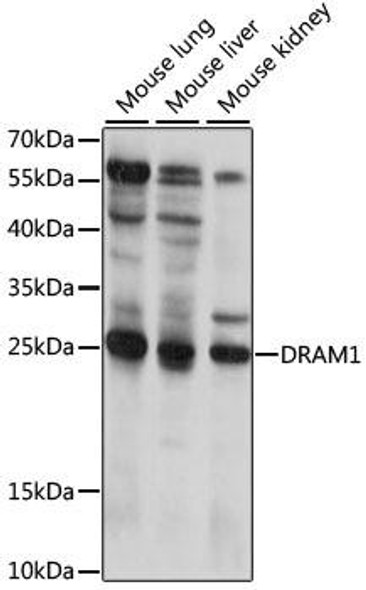 Anti-DRAM1 Antibody (CAB15468)