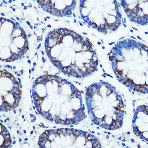 Anti-MAOB Antibody (CAB1568)