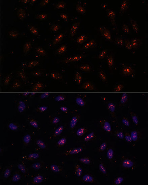 Anti-DNTTIP2 Antibody (CAB16120)