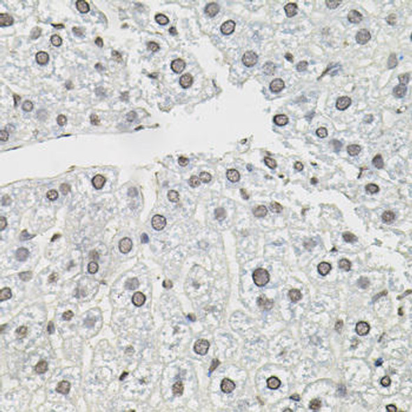 Anti-TCEB1 Antibody (CAB1989)