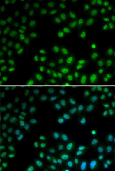 Anti-PIAS1 Antibody (CAB5729)