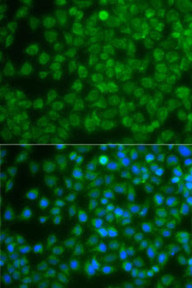 Anti-SPIB Antibody (CAB7451)