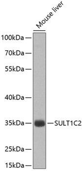 Anti-SULT1C2 Antibody (CAB8154)