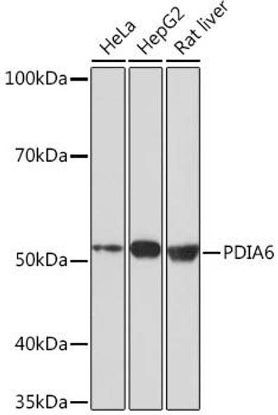 Anti-PDIA6 Antibody (CAB4260)