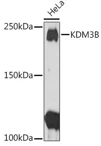 Anti-KDM3B Antibody (CAB2312)