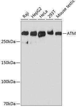 Anti-ATM [ARC0129] Monoclonal Antibody (CAB19650)