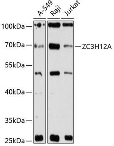 Anti-ZC3H12A Antibody (CAB12667)