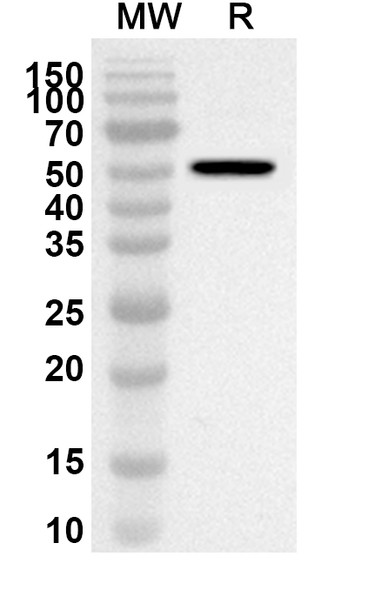 Anti-Casirivimab Polyclonal Antibody