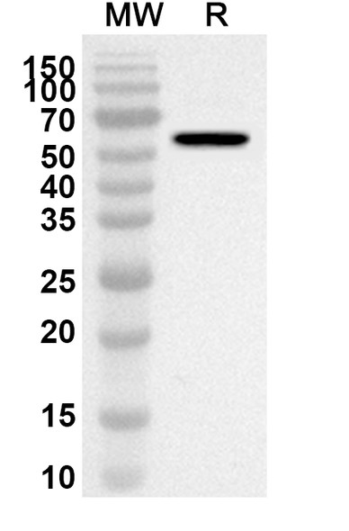 Anti-Evolocumab Polyclonal Antibody