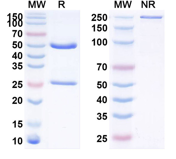 Anti-Siltuximab Non-Neutralizing Antibody [1A458]
