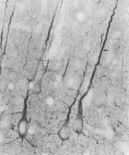 Immunohistochemistry analysis using Mouse Anti-PSD95 Monoclonal Antibody, Clone 7E3 (STMA00014). Tissue: Neocortex. Species: Rat. Primary Antibody: Mouse Anti-PSD95 Monoclonal Antibody (STMA00014) at 1:1000.