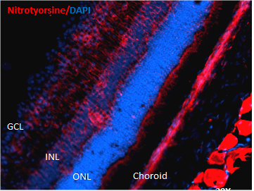 Immunohistochemistry analysis using Mouse Anti-Nitrotyrosine Monoclonal Antibody, Clone 39B6 (STMA00033). Tissue: Retinal Injury Model. Species: Mouse. Primary Antibody: Mouse Anti-Nitrotyrosine Monoclonal Antibody (STMA00033) at 1:1000. Secondary Antibody: Alexa Fluor 594 Goat Anti-Mouse (red). Courtesy of: Dr. Rajashekhar Gangaraju, University of Indiana, Department of Ophthalmology, Eugene and Marilyn Glick Eye Institute.