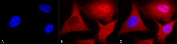 Immunocytochemistry/Immunofluorescence analysis using Mouse Anti-Ubiquitin Monoclonal Antibody, Clone 6C11-B3 (STMA00043). Tissue: Cervical cancer cell line (HeLa). Species: Human. Fixation: 2% Formaldehyde for 20 min at RT. Primary Antibody: Mouse Anti-Ubiquitin Monoclonal Antibody (STMA00043) at 1:100 for 12 hours at 4°C. Secondary Antibody: APC Goat Anti-Mouse (red) at 1:200 for 2 hours at RT.