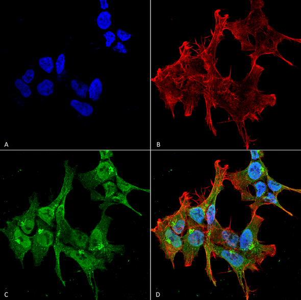 Immunocytochemistry/Immunofluorescence analysis using Mouse Anti-Piccolo Monoclonal Antibody, Clone 6H9-B6 (STMA00050). Tissue: Neuroblastoma cell line (SK-N-BE). Species: Human. Fixation: 4% Formaldehyde for 15 min at RT. Primary Antibody: Mouse Anti-Piccolo Monoclonal Antibody (STMA00050) at 1:100 for 60 min at RT. Secondary Antibody: Goat Anti-Mouse ATTO 488 at 1:100 for 60 min at RT.