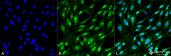 Immunocytochemistry/Immunofluorescence analysis using Mouse Anti-Ubiquitin Monoclonal Antibody, Clone FK2 (STMA00065). Tissue: Fibroblast cell line (NIH 3T3). Species: Mouse. Fixation: 4% Formaldehyde for 15 min at RT. Primary Antibody: Mouse Anti-Ubiquitin Monoclonal Antibody (STMA00065) at 1:100 for 60 min at RT. Secondary Antibody: Goat Anti-Mouse ATTO 488 at 1:100 for 60 min at RT.