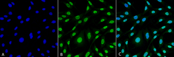 Immunocytochemistry/Immunofluorescence analysis using Mouse Anti-HO-1 (Rat) Monoclonal Antibody, Clone 6B8-2F2 (STMA00068). Tissue: Fibroblast cell line (NIH 3T3). Species: Mouse. Fixation: 4% Formaldehyde for 15 min at RT. Primary Antibody: Mouse Anti-HO-1 (Rat) Monoclonal Antibody (STMA00068) at 1:100 for 60 min at RT. Secondary Antibody: Goat Anti-Mouse ATTO 488 at 1:100 for 60 min at RT.