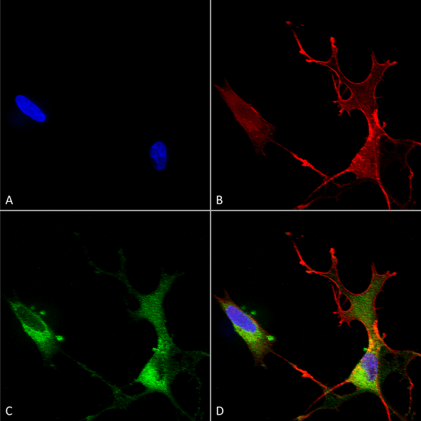 Immunocytochemistry/Immunofluorescence analysis using Mouse Anti-Cav1.2 Monoclonal Antibody, Clone S57 (STMA00080). Tissue: Neuroblastoma cells (SH-SY5Y). Species: Human. Fixation: 4% PFA for 15 min. Primary Antibody: Mouse Anti-Cav1.2 Monoclonal Antibody (STMA00080) at 1:50 for overnight at 4°C with slow rocking. Secondary Antibody: AlexaFluor 488 at 1:1000 for 1 hour at RT.