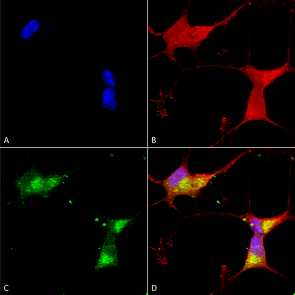 Immunocytochemistry/Immunofluorescence analysis using Mouse Anti-Kir2.1 Monoclonal Antibody, Clone S112 (STMA00087). Tissue: Neuroblastoma cells (SH-SY5Y). Species: Human. Fixation: 4% PFA for 15 min. Primary Antibody: Mouse Anti-Kir2.1 Monoclonal Antibody (STMA00087) at 1:50 for overnight at 4°C with slow rocking. Secondary Antibody: AlexaFluor 488 at 1:1000 for 1 hour at RT.