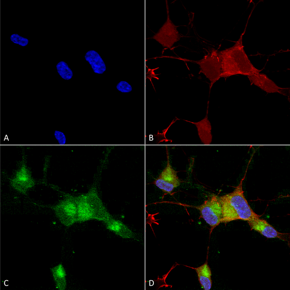Immunocytochemistry/Immunofluorescence analysis using Mouse Anti-Nav1.7 Monoclonal Antibody, Clone N68/6 (STMA00088). Tissue: Neuroblastoma cells (SH-SY5Y). Species: Human. Fixation: 4% PFA for 15 min. Primary Antibody: Mouse Anti-Nav1.7 Monoclonal Antibody (STMA00088) at 1:100 for overnight at 4°C with slow rocking. Secondary Antibody: AlexaFluor 488 at 1:1000 for 1 hour at RT.