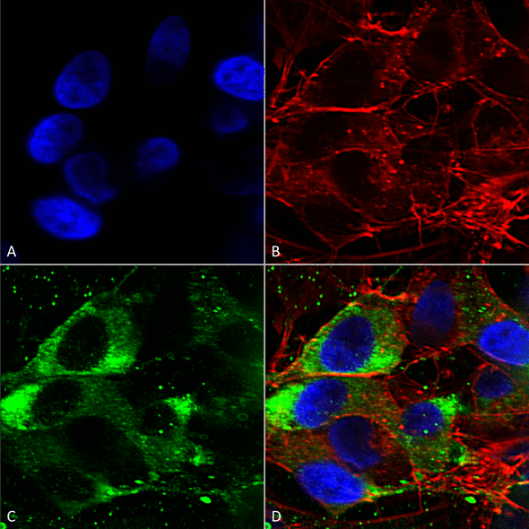 Immunocytochemistry/Immunofluorescence analysis using Mouse Anti-Nav1.8 Monoclonal Antibody, Clone S134 (STMA00100). Tissue: Neuroblastoma cells (SH-SY5Y). Species: Human. Fixation: 4% PFA for 15 min. Primary Antibody: Mouse Anti-Nav1.8 Monoclonal Antibody (STMA00100) at 1:50 for overnight at 4°C with slow rocking. Secondary Antibody: AlexaFluor 488 at 1:1000 for 1 hour at RT.