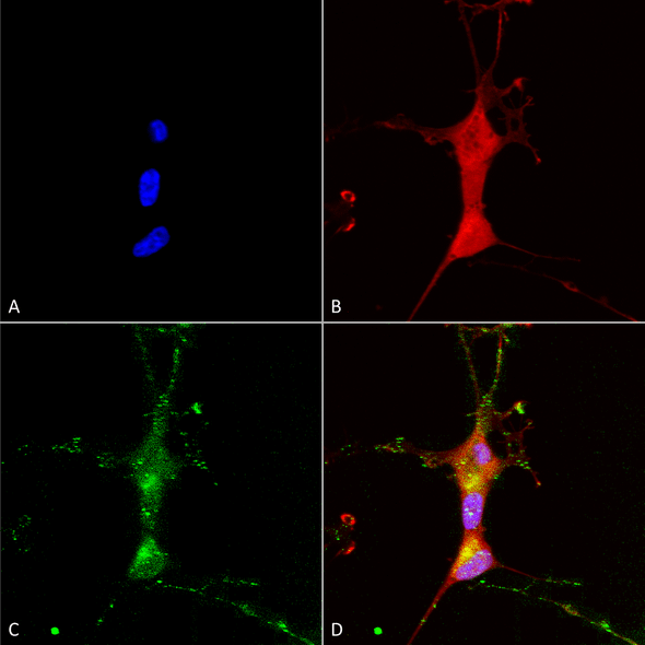 Immunocytochemistry/Immunofluorescence analysis using Mouse Anti-TrpC7 Monoclonal Antibody, Clone N64A/36 (STMA00101). Tissue: Neuroblastoma cells (SH-SY5Y). Species: Human. Fixation: 4% PFA for 15 min. Primary Antibody: Mouse Anti-TrpC7 Monoclonal Antibody (STMA00101) at 1:100 for overnight at 4°C with slow rocking. Secondary Antibody: AlexaFluor 488 at 1:1000 for 1 hour at RT.