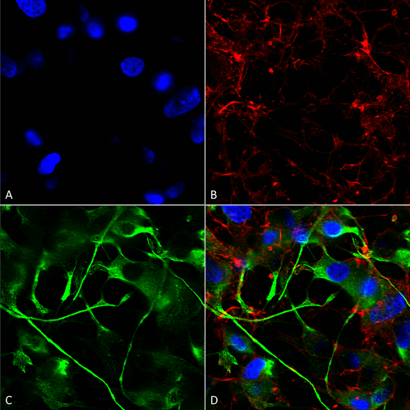 Immunocytochemistry/Immunofluorescence analysis using Mouse Anti-VAChT Monoclonal Antibody, Clone S6 (STMA00108). Tissue: Neuroblastoma cells (SH-SY5Y). Species: Human. Fixation: 4% PFA for 15 min. Primary Antibody: Mouse Anti-VAChT Monoclonal Antibody (STMA00108) at 1:200 for overnight at 4°C with slow rocking. Secondary Antibody: AlexaFluor 488 at 1:1000 for 1 hour at RT.