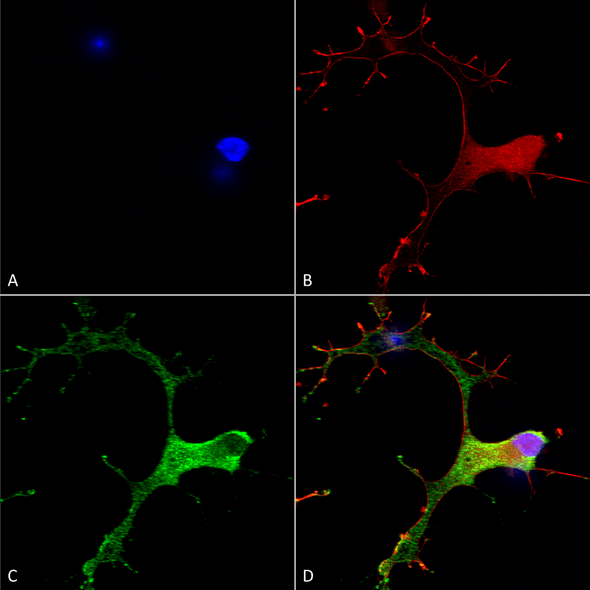 Immunocytochemistry/Immunofluorescence analysis using Mouse Anti-GABA-B Receptor 1 Monoclonal Antibody, Clone N93A/49 (STMA00118). Tissue: Neuroblastoma cells (SH-SY5Y). Species: Human. Fixation: 4% PFA for 15 min. Primary Antibody: Mouse Anti-GABA-B Receptor 1 Monoclonal Antibody (STMA00118) at 1:50 for overnight at 4°C with slow rocking. Secondary Antibody: AlexaFluor 488 at 1:1000 for 1 hour at RT.