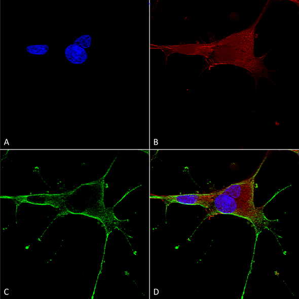 Immunocytochemistry/Immunofluorescence analysis using Mouse Anti-GluN1 Monoclonal Antibody, Clone N308/48 (STMA00124). Tissue: Neuroblastoma cells (SH-SY5Y). Species: Human. Fixation: 4% PFA for 15 min. Primary Antibody: Mouse Anti-GluN1 Monoclonal Antibody (STMA00124) at 1:50 for overnight at 4°C with slow rocking. Secondary Antibody: AlexaFluor 488 at 1:1000 for 1 hour at RT.