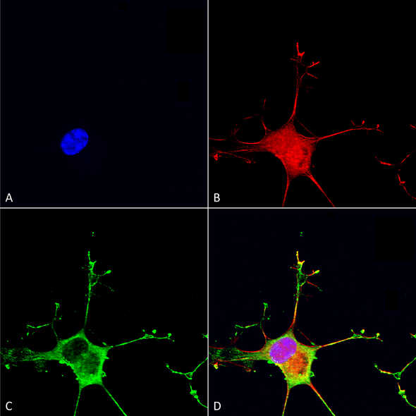 Immunocytochemistry/Immunofluorescence analysis using Mouse Anti-Dicer Monoclonal Antibody, Clone N167/7 (STMA00126). Tissue: Neuroblastoma cells (SH-SY5Y). Species: Human. Fixation: 4% PFA for 15 min. Primary Antibody: Mouse Anti-Dicer Monoclonal Antibody (STMA00126) at 1:50 for overnight at 4°C with slow rocking. Secondary Antibody: AlexaFluor 488 at 1:1000 for 1 hour at RT.