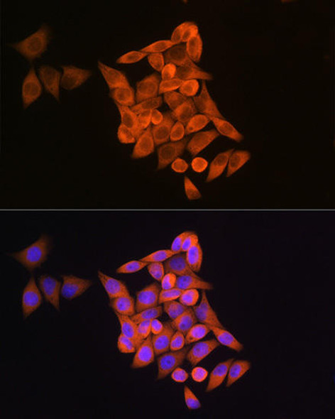 Anti-RRM1 Antibody (CAB13348)