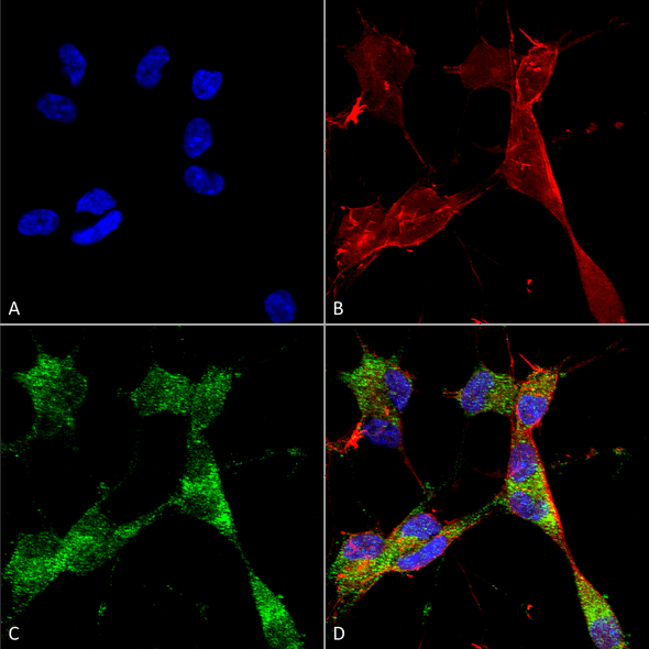 Immunocytochemistry/Immunofluorescence analysis using Mouse Anti-PINK1 Monoclonal Antibody, Clone N4/15 (STMA00148). Tissue: Neuroblastoma cells (SH-SY5Y). Species: Human. Fixation: 4% PFA for 15 min. Primary Antibody: Mouse Anti-PINK1 Monoclonal Antibody (STMA00148) at 1:50 for overnight at 4°C with slow rocking. Secondary Antibody: AlexaFluor 488 at 1:1000 for 1 hour at RT.