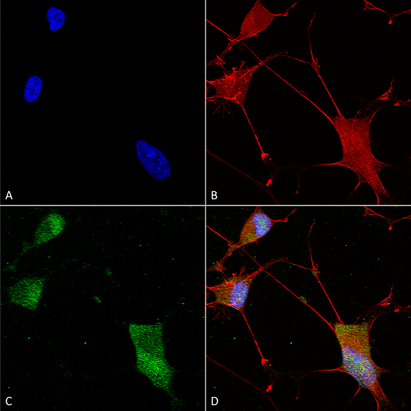 Immunocytochemistry/Immunofluorescence analysis using Mouse Anti-Neuroligin 1 Monoclonal Antibody, Clone N97A/31 (STMA00156). Tissue: Neuroblastoma cells (SH-SY5Y). Species: Human. Fixation: 4% PFA for 15 min. Primary Antibody: Mouse Anti-Neuroligin 1 Monoclonal Antibody (STMA00156) at 1:100 for overnight at 4°C with slow rocking. Secondary Antibody: AlexaFluor 488 at 1:1000 for 1 hour at RT.